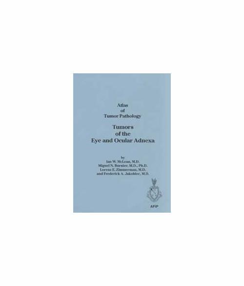 Tumors of the Eye and Ocular Adnexa: 12 - copertina