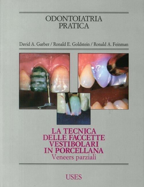 La Tecnica delle Faccette Vestibolari in Porcellana - copertina