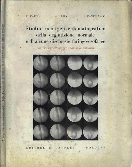 Studio roentgen-cinematografico della deglutizione normale e di alcune discinesie faringo-esofagee - P. Carcò - copertina