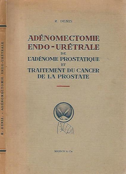 Adenomectomie endo - uretrale de l'adenome prostatique et traitement du cancer de la prostate - Roland Denis - copertina