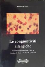 Le congiuntiviti allergiche