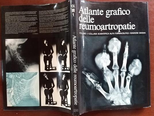 Atlante grafico delle reumoartropatie - copertina