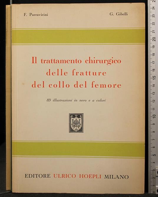 Il Trattamento Chirurgico Delle Fratture Del Collo. - A. Parravicini - copertina