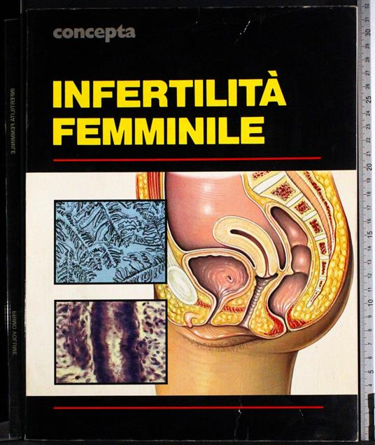 Concepta. Infertilità femminile. Vol 1 - copertina