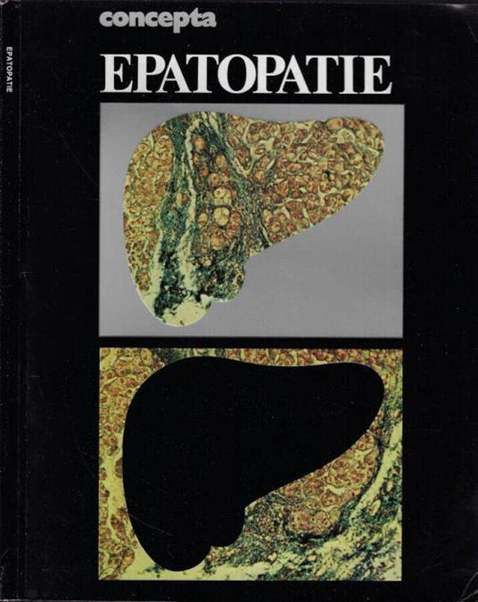 Concepta- Epatopatie - Giuseppe Labò - copertina