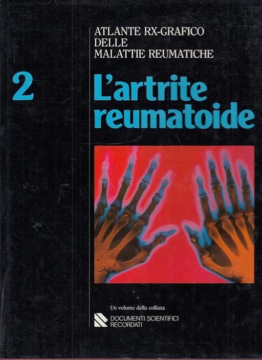 L' artrite Reumatoide 2 - Ignazio Caruso - copertina