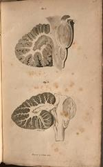 Observations on the structure of the brain. Comprising an estimate of claims drs. Gall and Spurzheim to discovery in the anatomy of the organ. By John Gordon