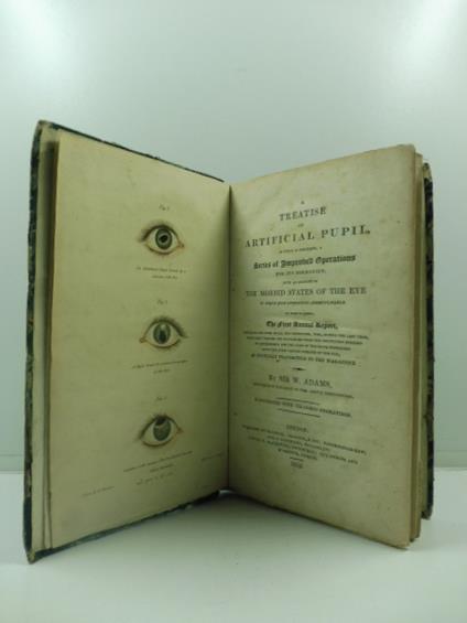 A treatise on artificial pupil in which is described a series of improved operations for its formation whith an account of the morbid states of the eye to which such operations are aplicable to this is added the first annual report detailing the case - copertina