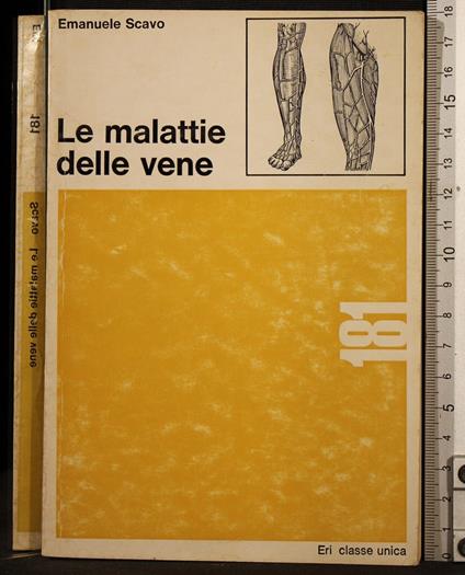 Le malattie delle vene - Emanuele Scavo - copertina