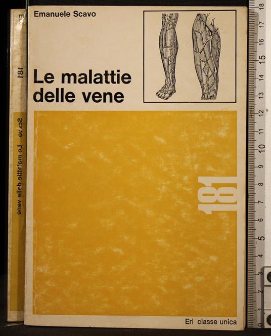 Le malattie delle vene - Emanuele Scavo - copertina