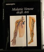 Malattie Venose Degli Arti