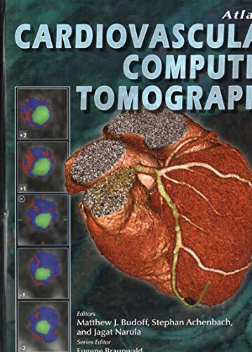 Atlas of Cardiovascular computed Tomography- 2008 - copertina