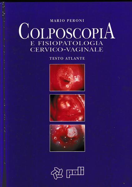 Colposcopia e fisiopatologia cervico-vaginale. Testo atlante - Mario Speroni - copertina