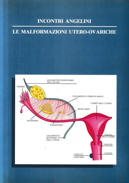 Le malformazioni utero-ovariche - copertina