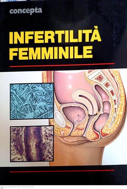 Infertilità femminile. Vol. 1 - copertina