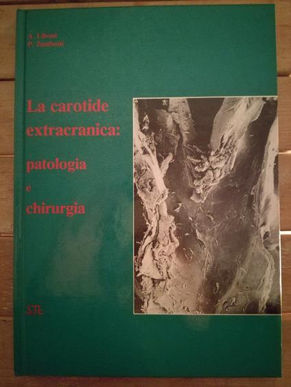 La Carotide Extracranica: Patologia E Chirurgia - copertina