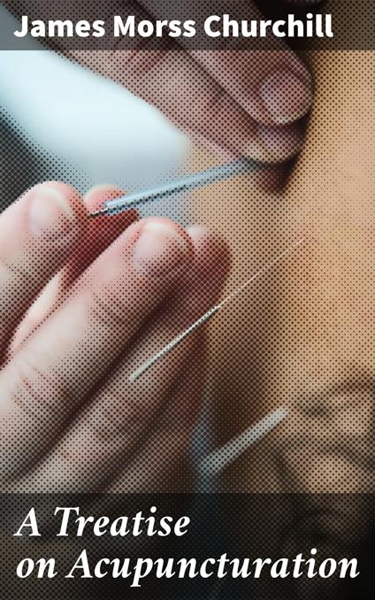 A Treatise on Acupuncturation