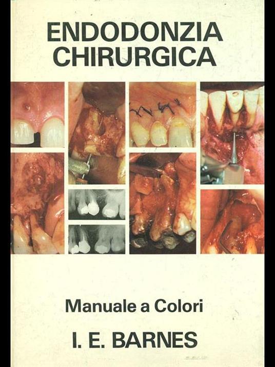 Endodonzia chirurgica - 4