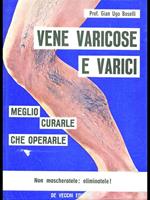 Vene varicose e varici