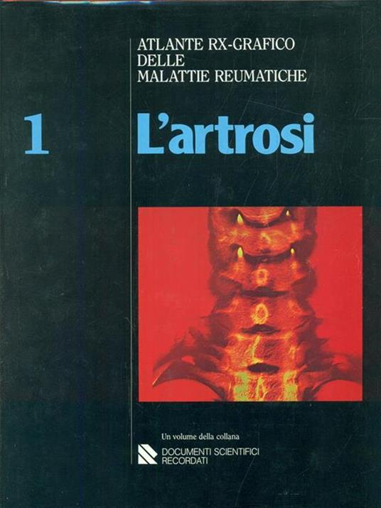 Atlante rx-grafico delle malattie reumatiche. L' artrosi - Ignazio Caruso,F. Costa - 3