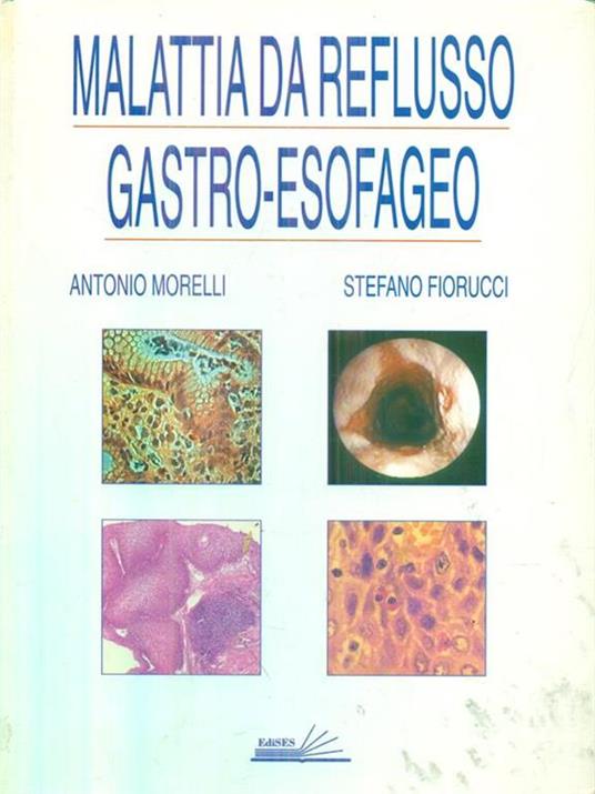 Malattia da reflusso gastro-esofageo - Fiorucci,Morelli - 3