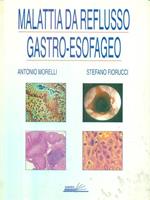 Malattia da reflusso gastro-esofageo