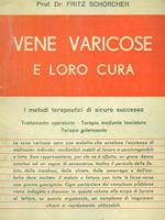 vene varicose e loro cura