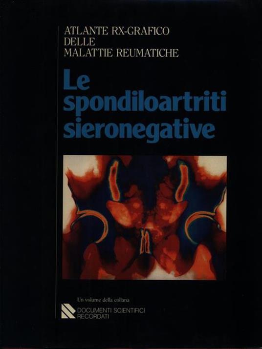 Le spondiloartriti sieronegative - 4