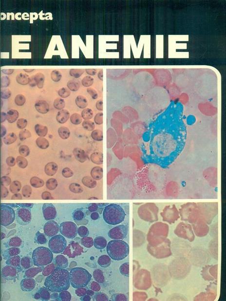 Anemia - copertina