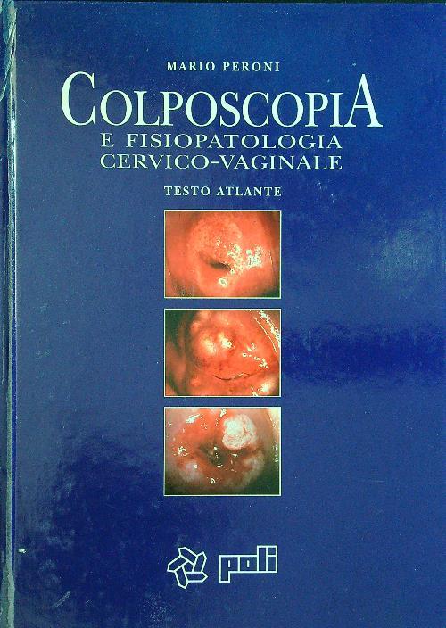 Colposcopia e fisiopatologia cervico-vaginale - Mario Speroni - copertina