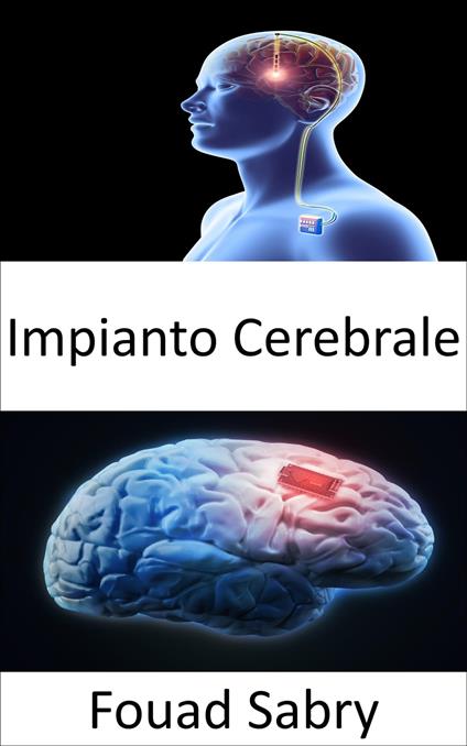 Impianto Cerebrale - Fouad Sabry,Cosimo Pinto - ebook