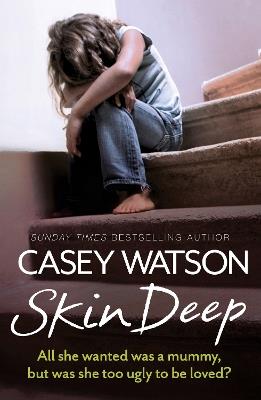 Skin Deep: All She Wanted Was a Mummy, but Was She Too Ugly to be Loved? - Casey Watson - cover
