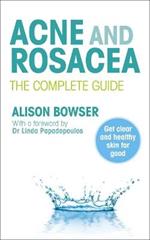 Acne and Rosacea: The Complete Guide