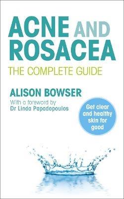Acne and Rosacea: The Complete Guide - Alison Bowser - cover