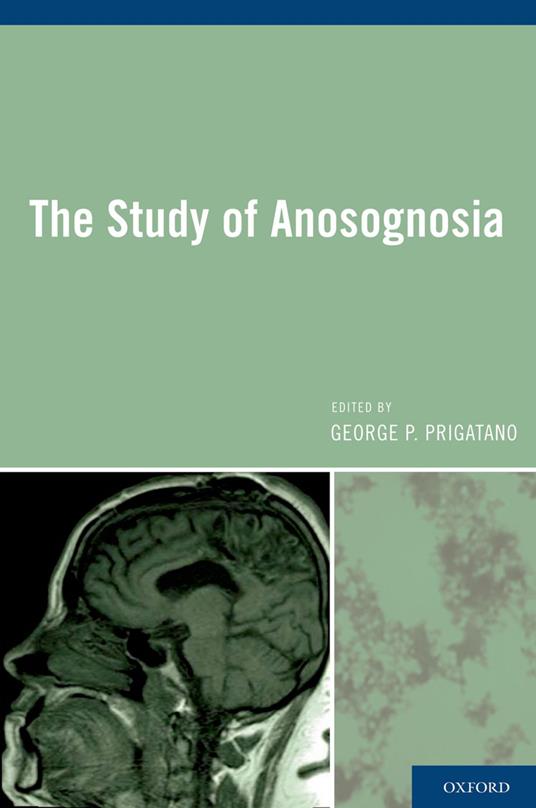 The Study of Anosognosia