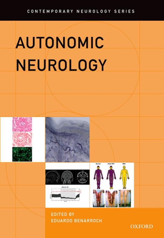 Autonomic Neurology