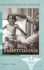 Tuberculosis