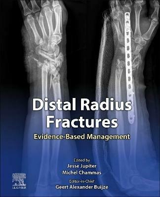 Distal Radius Fractures: Evidence-Based Management - cover