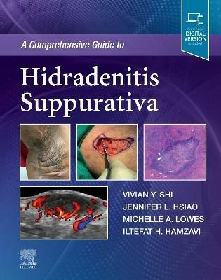 A Comprehensive Guide to Hidradenitis Suppurativa - Vivian Y. Shi,Jennifer L. Hsiao,Michelle A. Lowes - cover