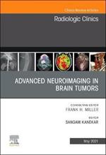 Advanced Neuroimaging in Brain Tumors, An Issue of Radiologic Clinics of North America