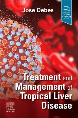 Treatment and Management of Tropical Liver Disease - cover