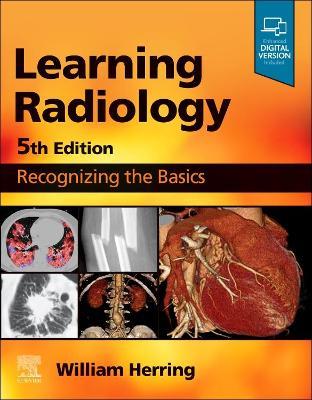 Learning Radiology: Recognizing the Basics - William Herring - cover