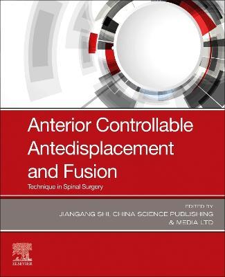 Anterior Controllable Antedisplacement and Fusion: Technique in Spinal Surgery - cover