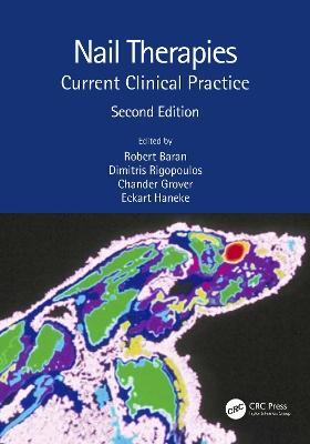 Nail Therapies: Current Clinical Practice - cover