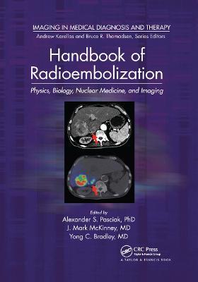 Handbook of Radioembolization: Physics, Biology, Nuclear Medicine, and Imaging - cover