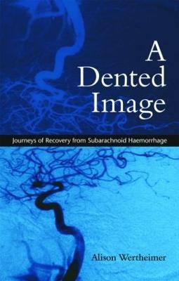 A Dented Image: Journeys of Recovery from Subarachnoid Haemorrhage - Alison Wertheimer - cover