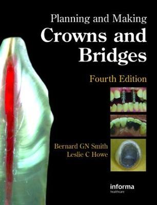 Planning and Making Crowns and Bridges - Bernard G.N. Smith,Leslie C. Howe - cover