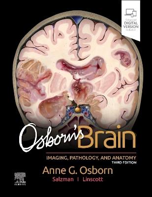 Osborn's Brain - Anne G. Osborn,Luke L. Linscott,Karen L. Salzman - cover