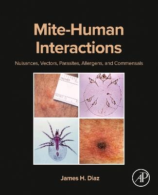 Mite-Human Interactions: Nuisances, Vectors, Parasites, Allergens, and Commensals - James H. Diaz - cover