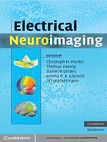 Electrical Neuroimaging